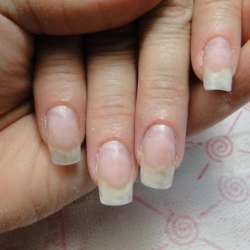 Причины проблем с ногтями после наращивания